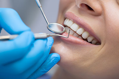 Alta Dental | Blanqueamientos de Dientes, Extracciones de Muelas del Juicio and Protector Bucal