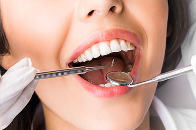 Alta Dental |   xido Nitroso y Sedaci  n Oral, Extracciones Simples y Quir  rgicas and Blanqueamientos de Dientes