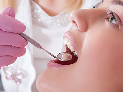 Alta Dental | Terapia Periodontal o Limpiezas Profundas, Sellantes y Servicios Preventivos and   xido Nitroso y Sedaci  n Oral